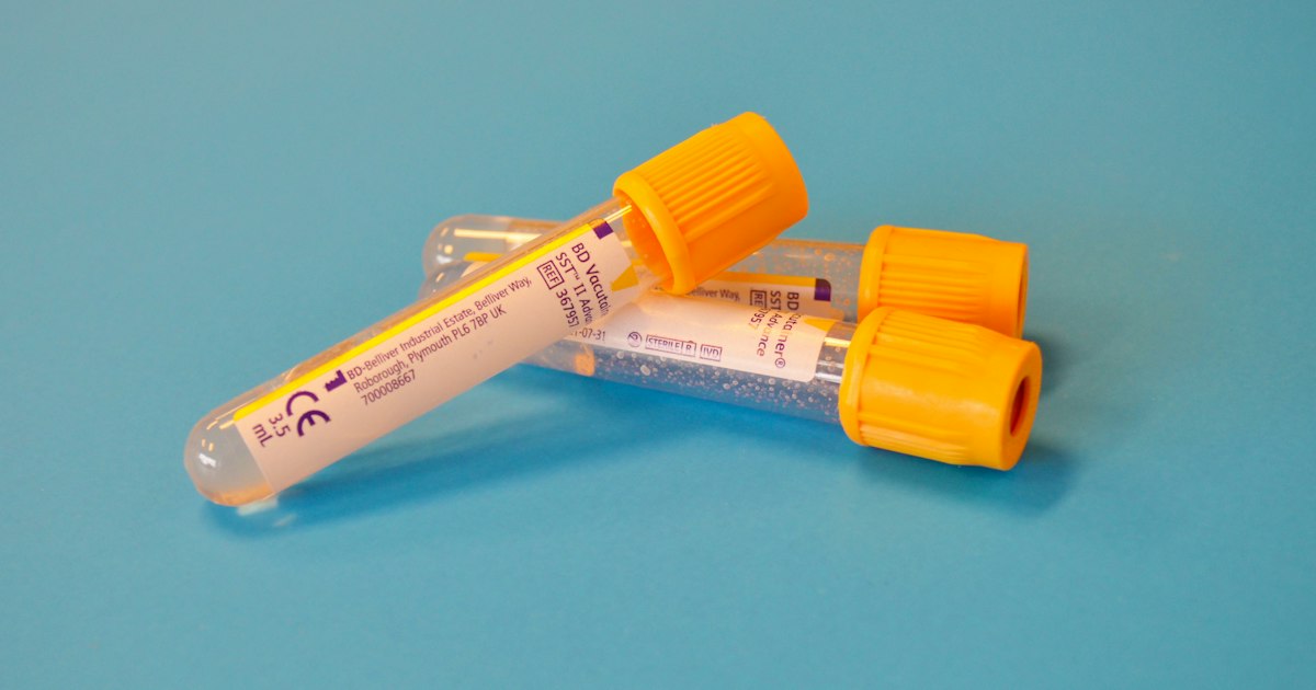 How to Prepare for the Lipoprotein(a) Test: Rules for Getting Tested