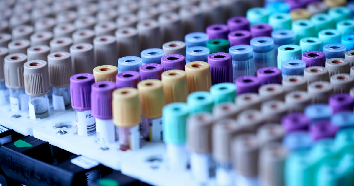Vitamin D (25-OH): What the Test Shows and Why It Matters for an Athlete