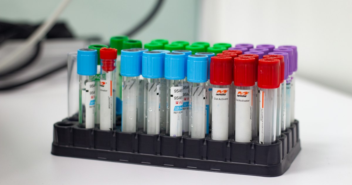 Vitamin B12: What the Test Shows and Why It Matters for an Athlete