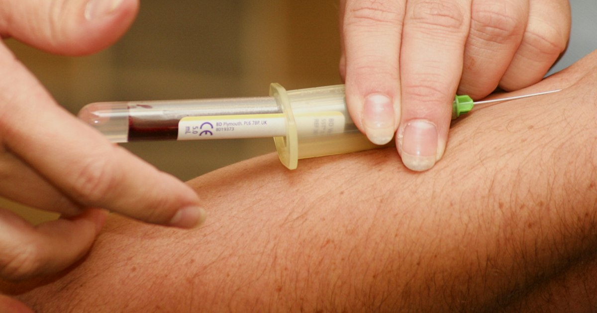 Vitamin B12 Above or Below Normal: Causes in Athletes and What to Do